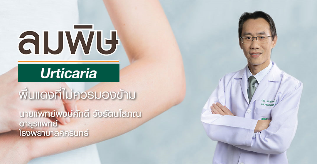 ‘โรคลมพิษ’  ผื่นแดงบนผิวหนังที่ไม่ควรมองข้าม