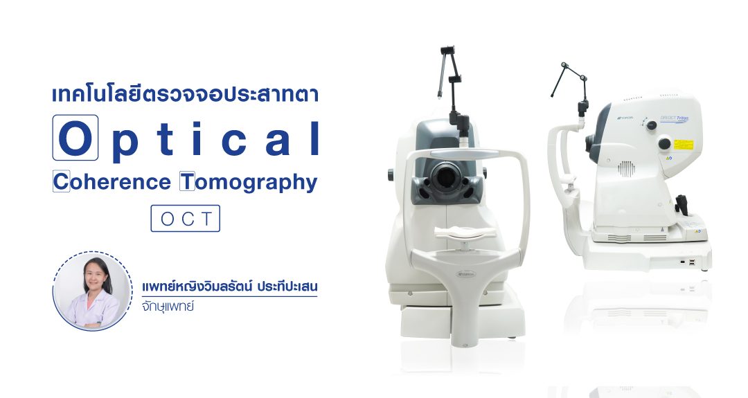 เทคโนโลยีตรวจจอประสาทตา Optical coherence tomography (OCT)