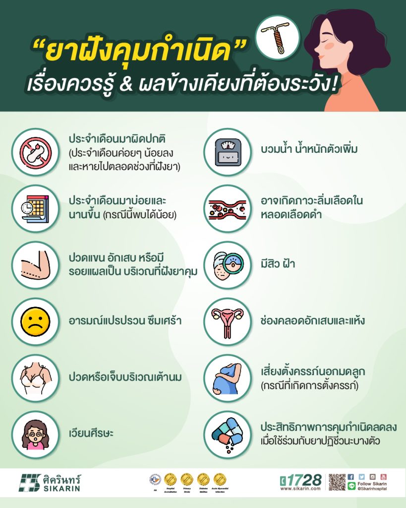 ยาฝังคุมกำเนิด