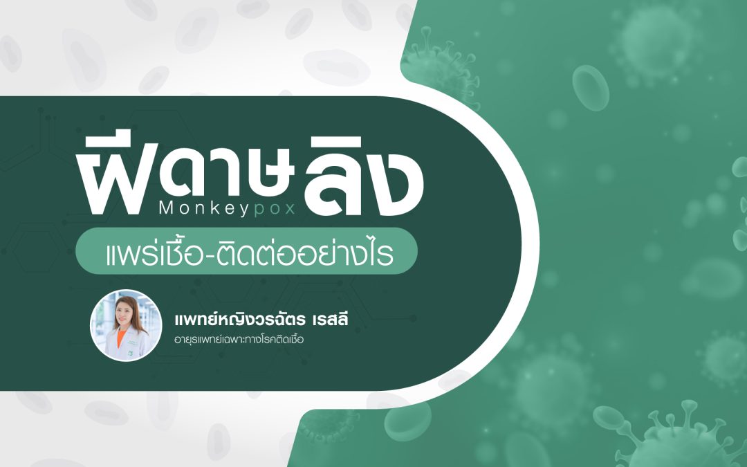 Monkeypox “โรคฝีดาษลิง” แพร่เชื้อ-ติดต่ออย่างไร?
